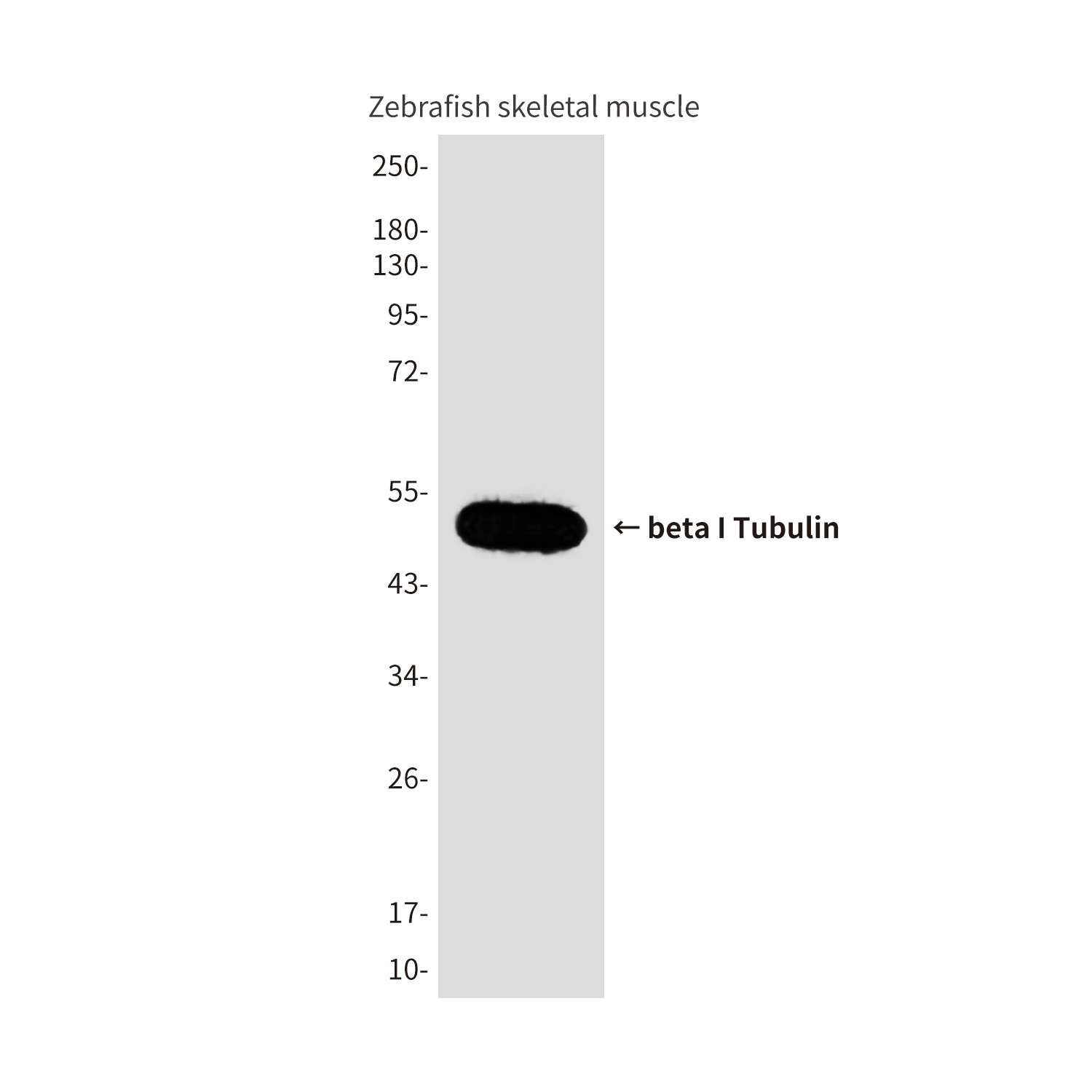beta I Tubulin