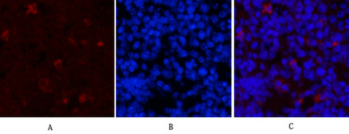 Mouse Monoclonal Antibody to Hydroxyacid Oxidase 1