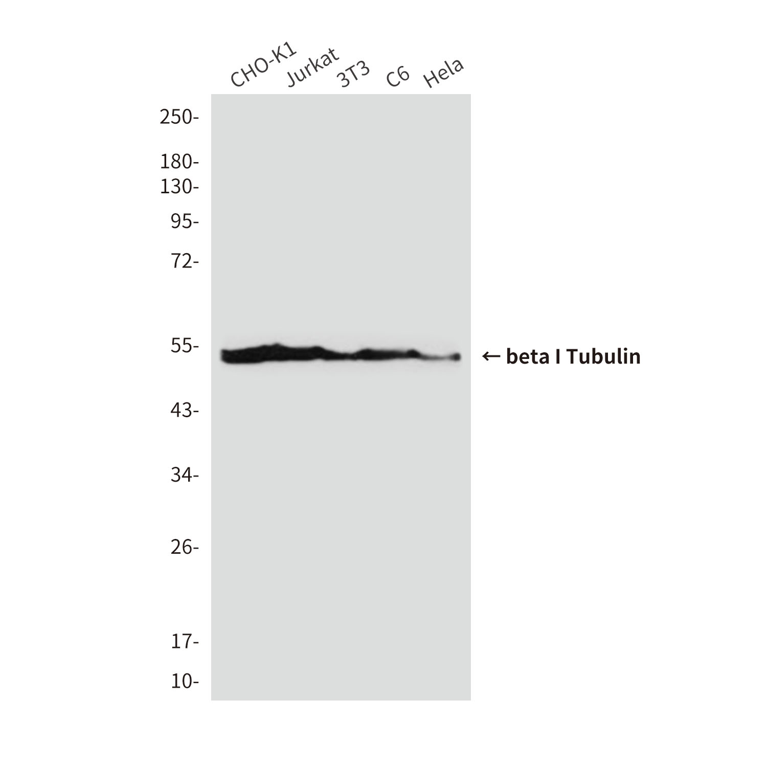 beta I Tubulin
