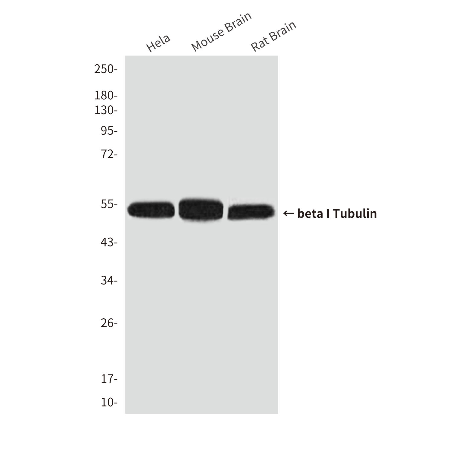 Mouse Monoclonal Antibody to beta I Tubulin
