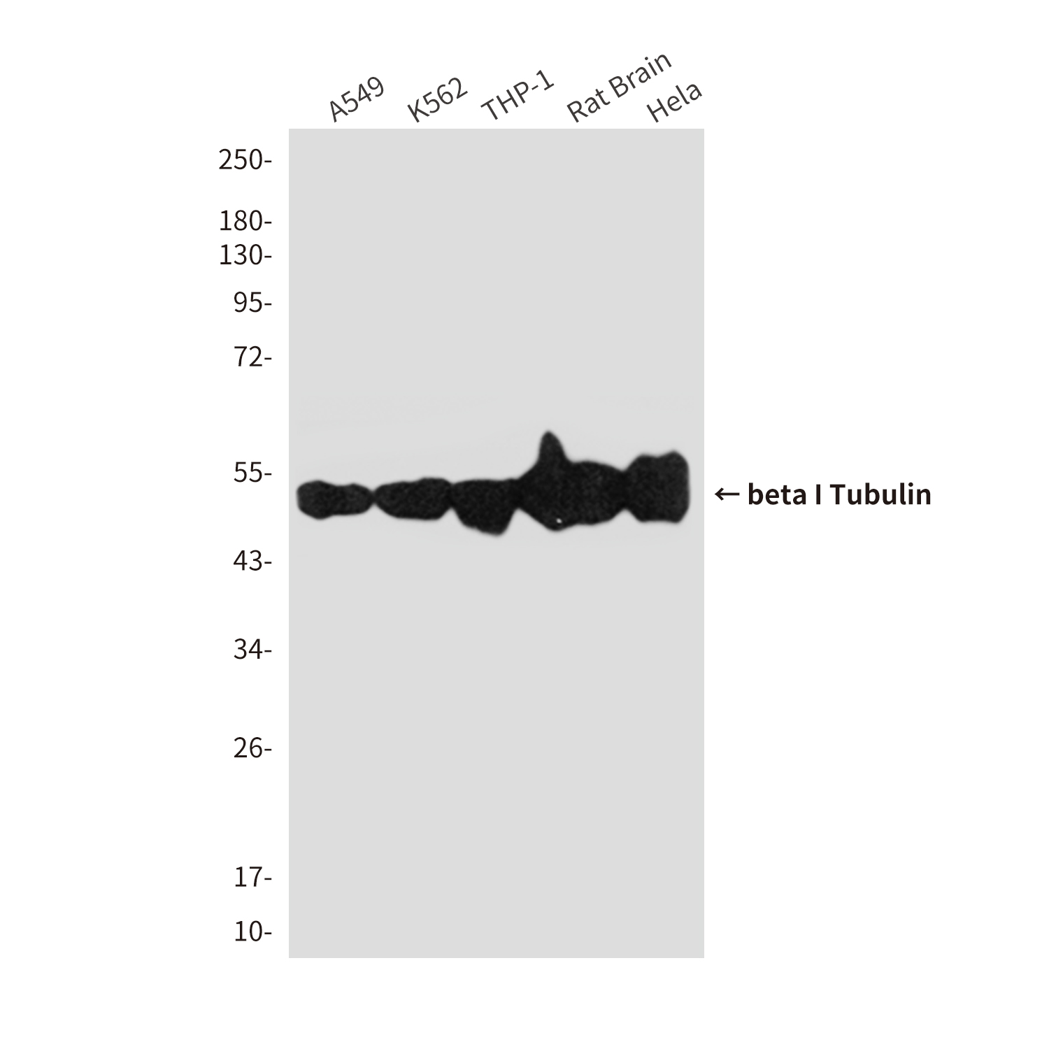 Mouse Monoclonal Antibody to beta I Tubulin