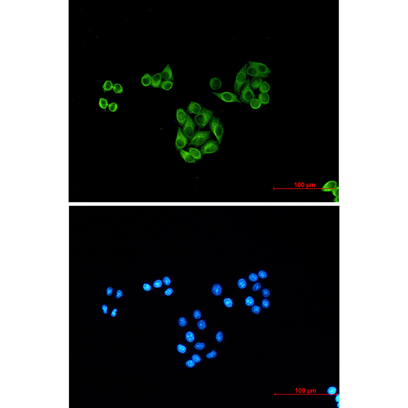 Mouse Monoclonal Antibody to beta I Tubulin