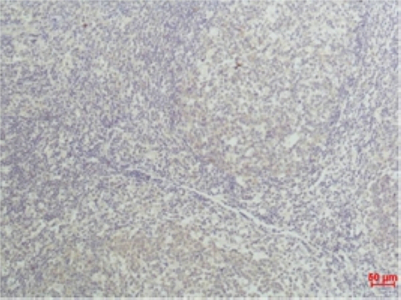 Mouse Monoclonal Antibody to TNF alpha