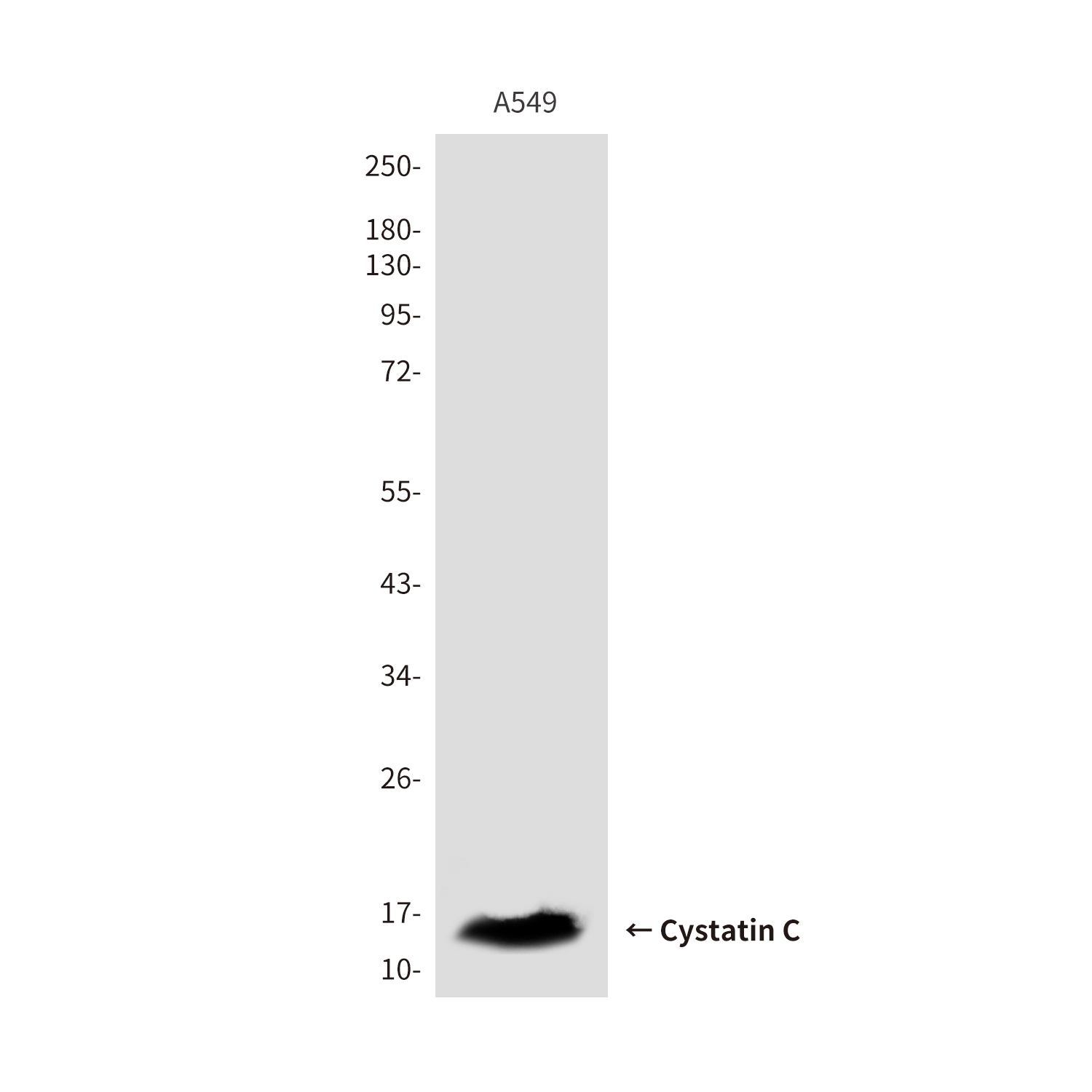 Cystatin C