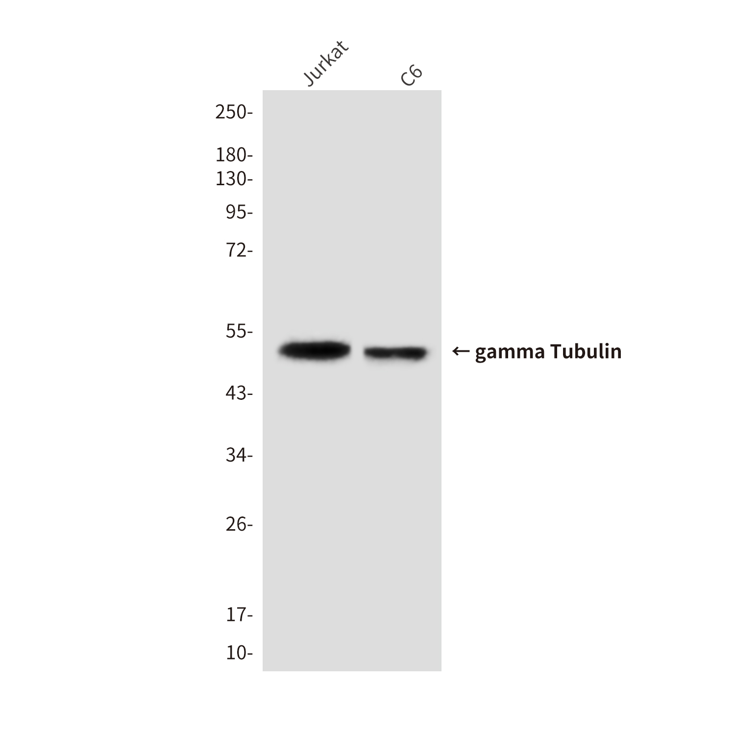 gamma Tubulin