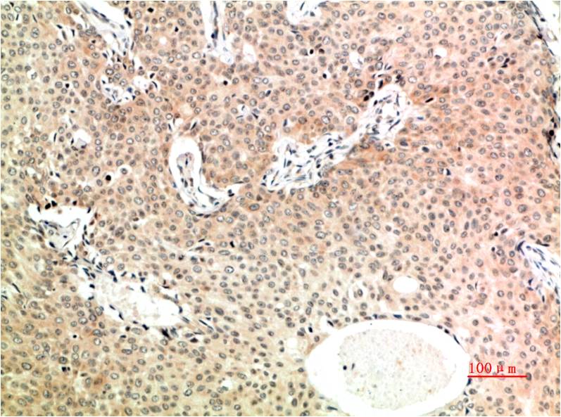 Mouse Monoclonal Antibody to TGF beta 1