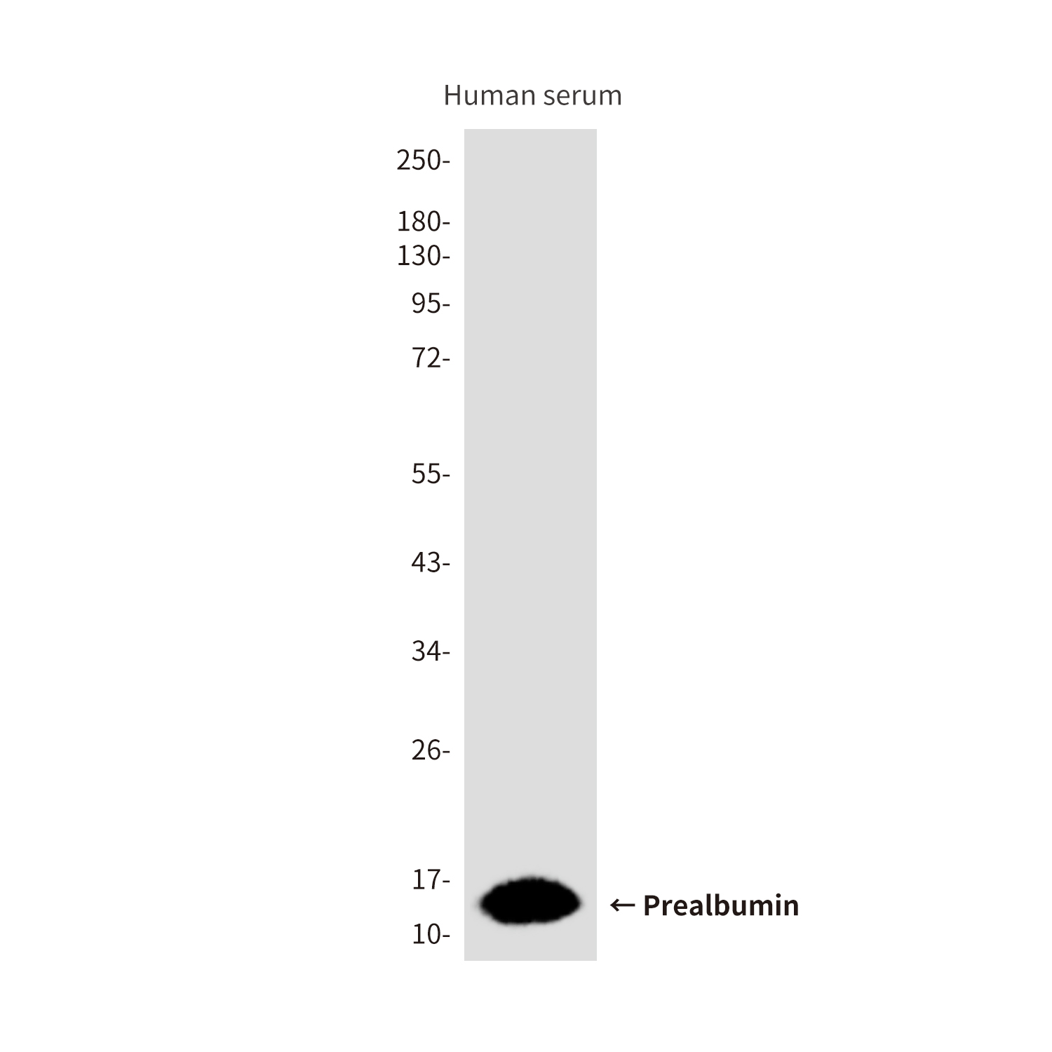 Prealbumin