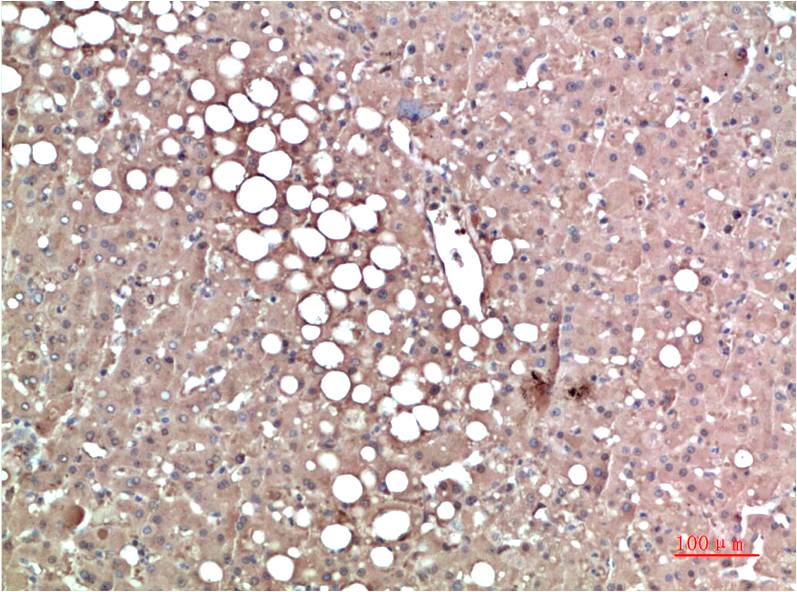 Mouse Monoclonal Antibody to Prealbumin