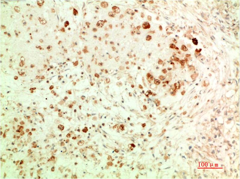 Mouse Monoclonal Antibody to APG5L