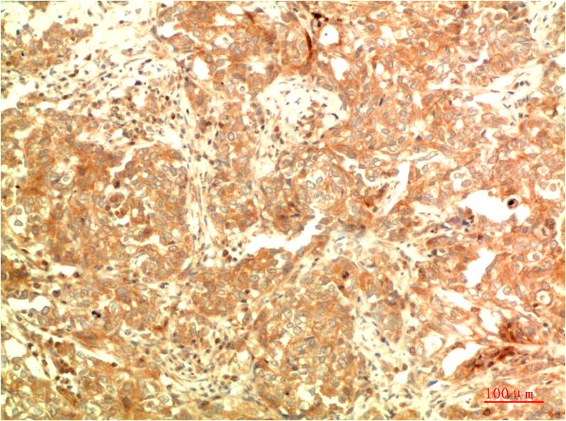 Mouse Monoclonal Antibody to APG5L