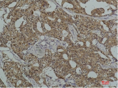 Mouse Monoclonal Antibody to Hsc70