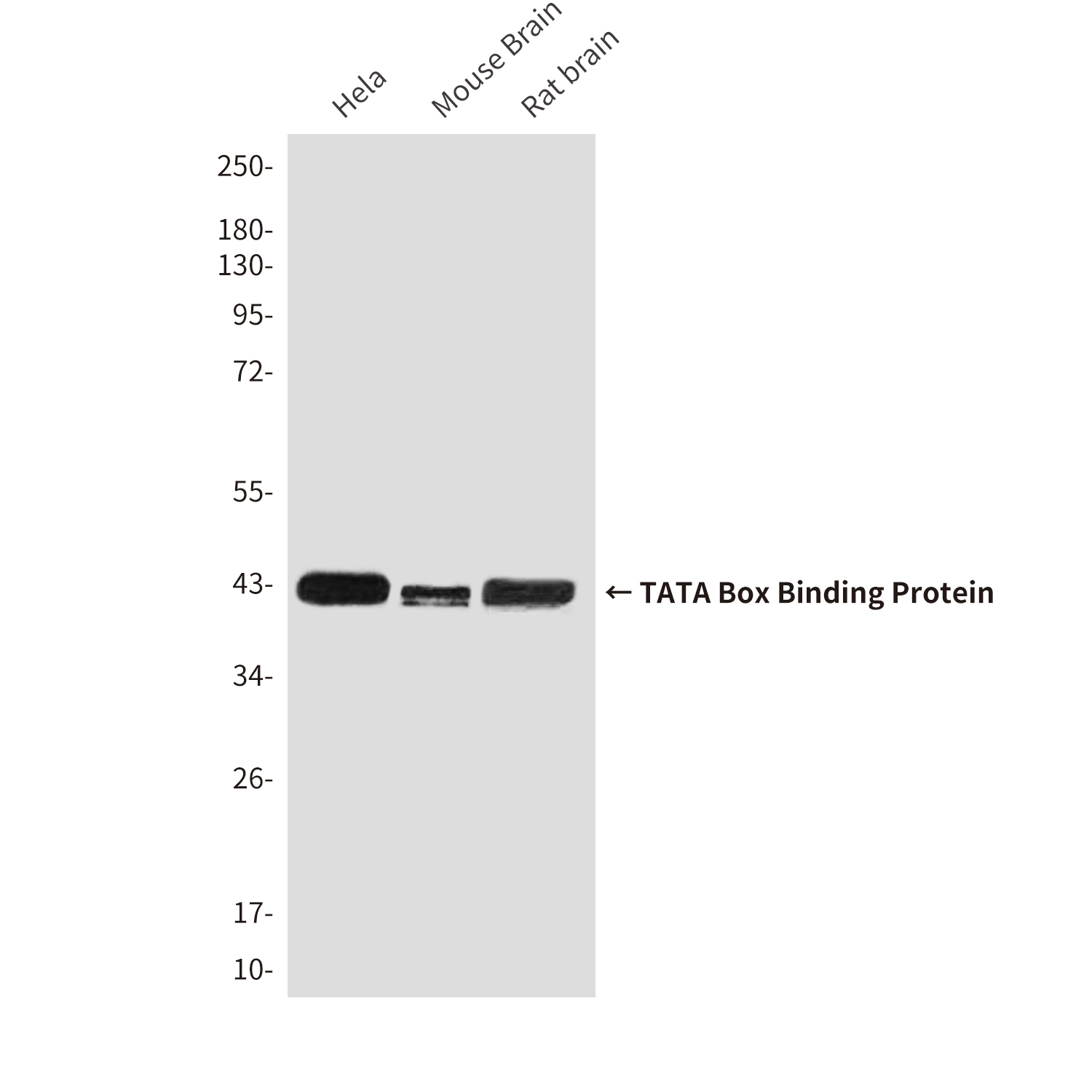 TATA Box Binding Protein