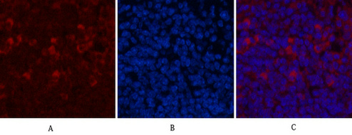 Mouse Monoclonal Antibody to CD68