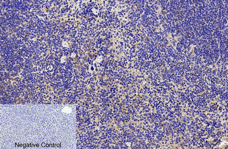 Mouse Monoclonal Antibody to CD68