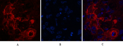 Carcino Embryonic Antigen CEA