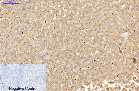 Mouse Monoclonal Antibody to Carcino Embryonic Antigen CEA