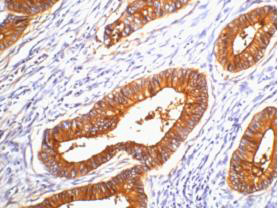 Mouse Monoclonal Antibody to Carcino Embryonic Antigen CEA