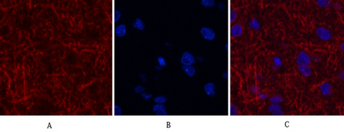 Mouse Monoclonal Antibody to MAP2