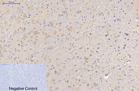 Mouse Monoclonal Antibody to MAP2