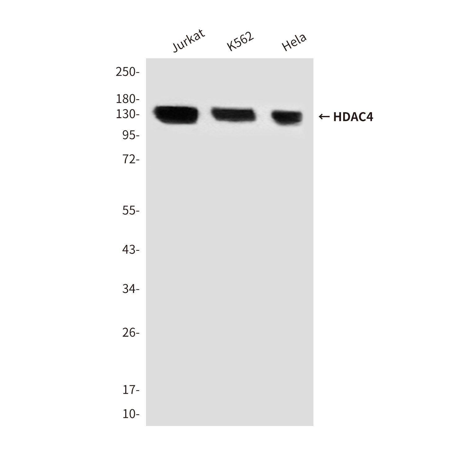 HDAC4