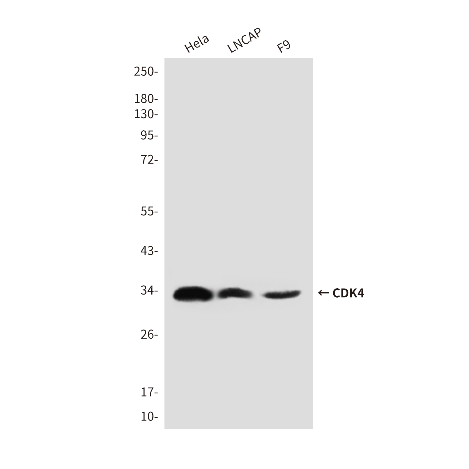 CDK4