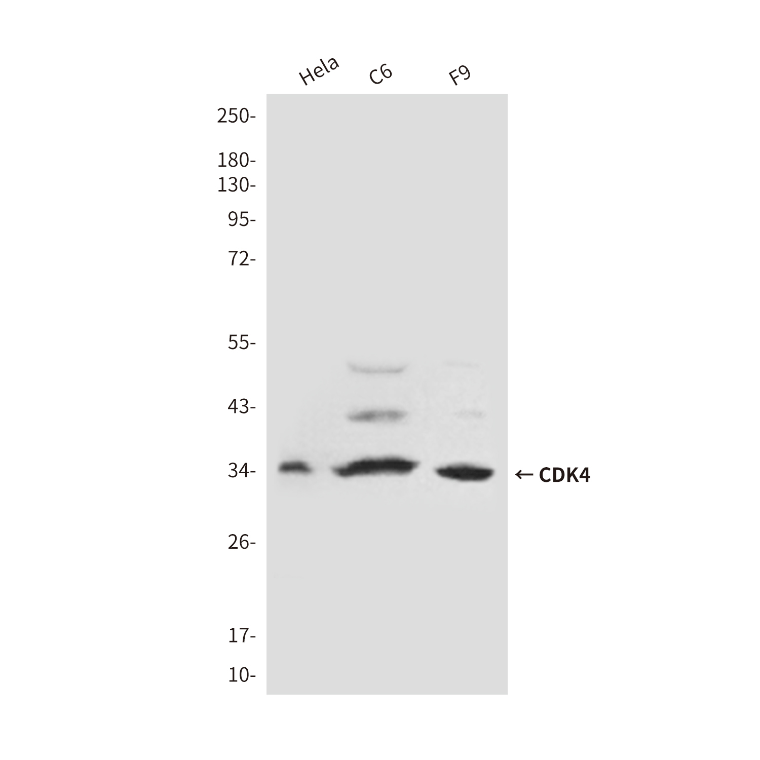 Mouse Monoclonal Antibody to CDK4