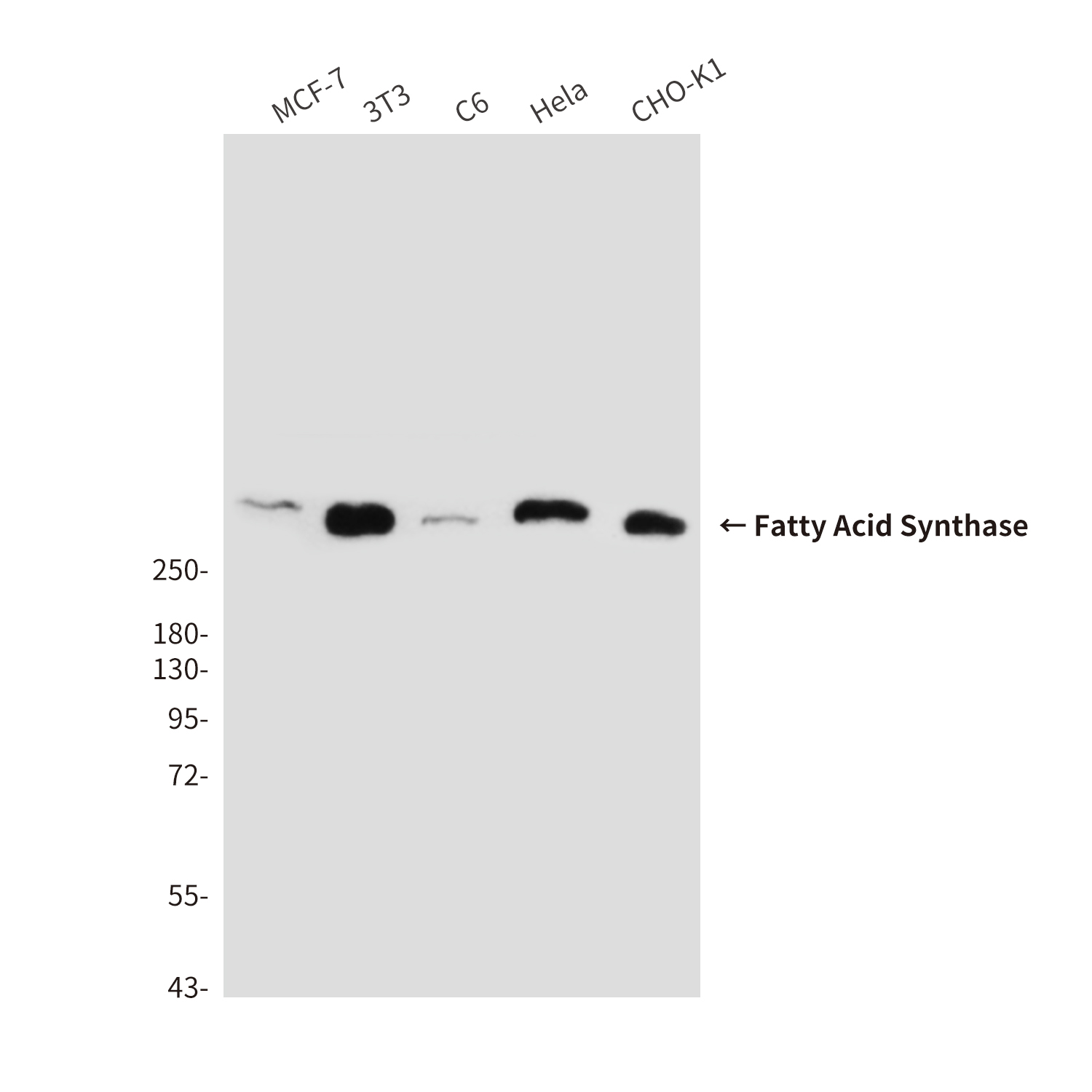 Fatty Acid Synthase