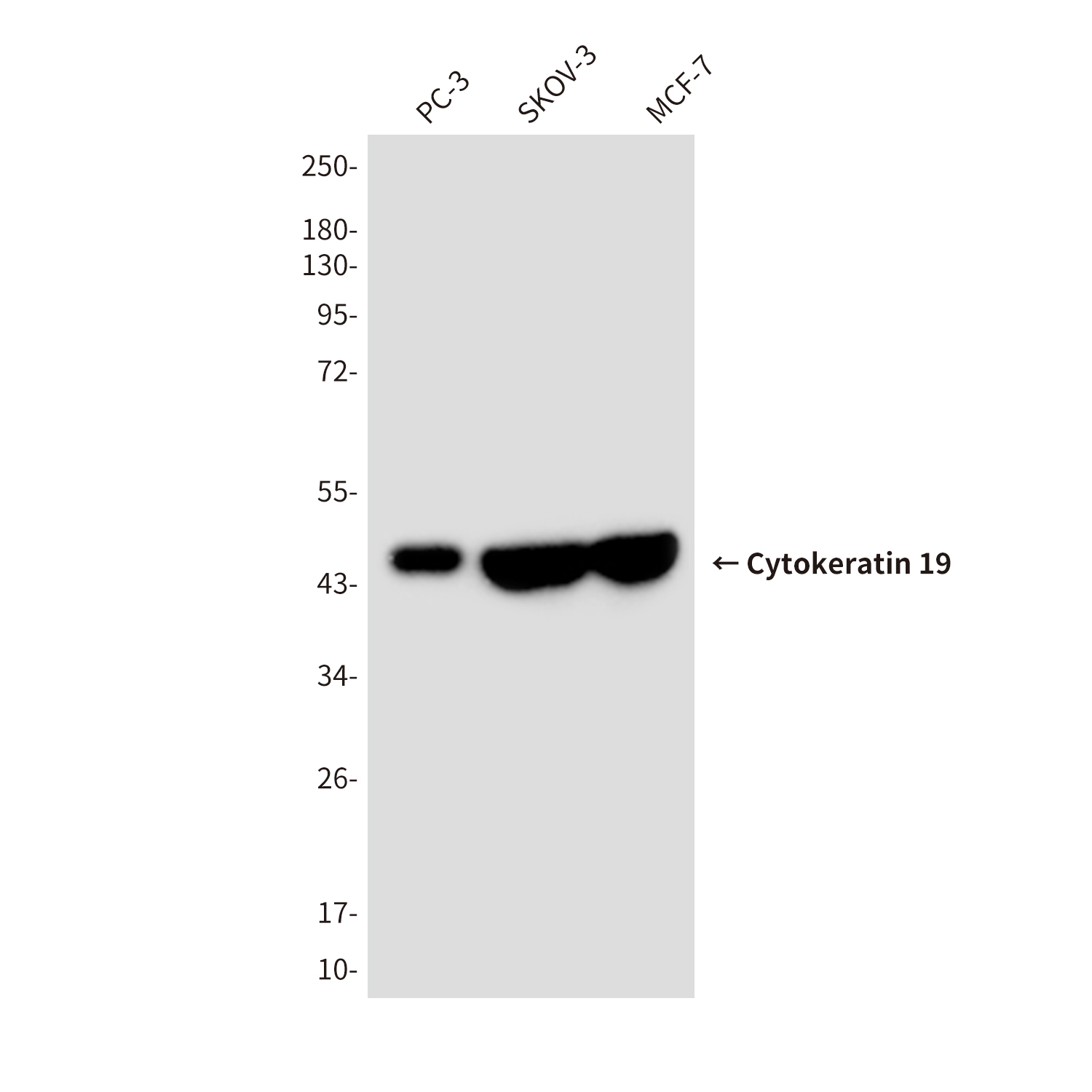 Cytokeratin 19