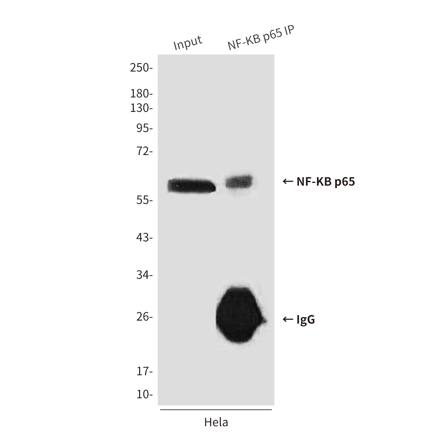 Mouse Monoclonal Antibody to NF-KB p65