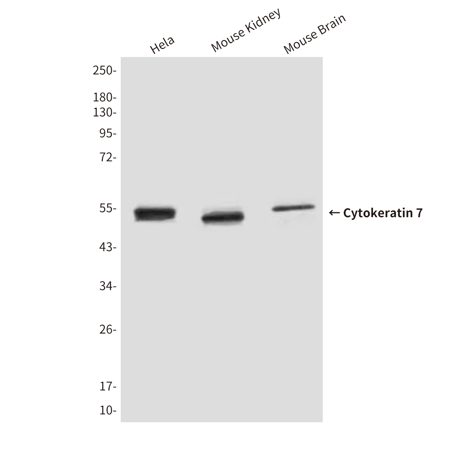Cytokeratin 7