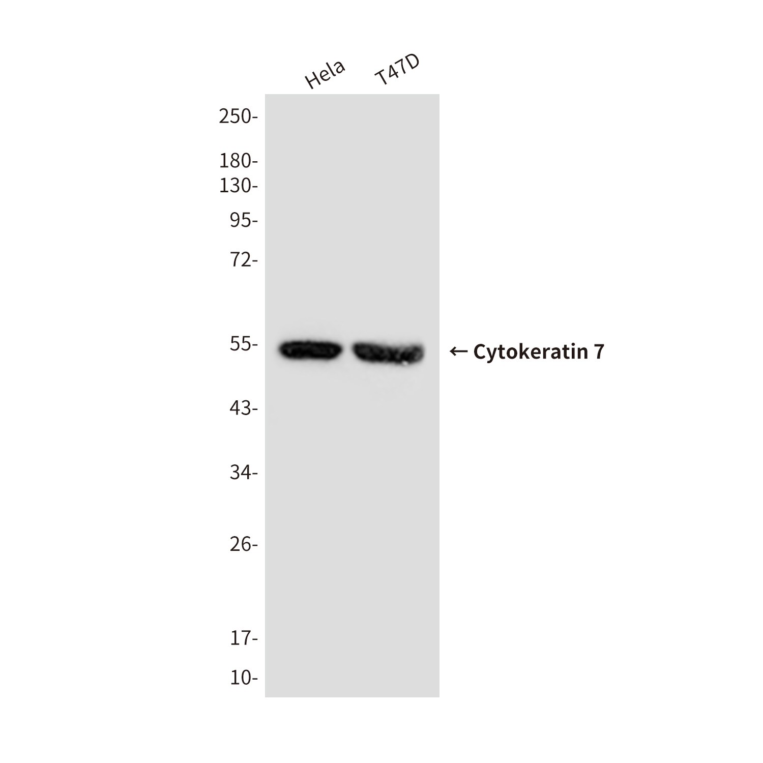 Mouse Monoclonal Antibody to Cytokeratin 7