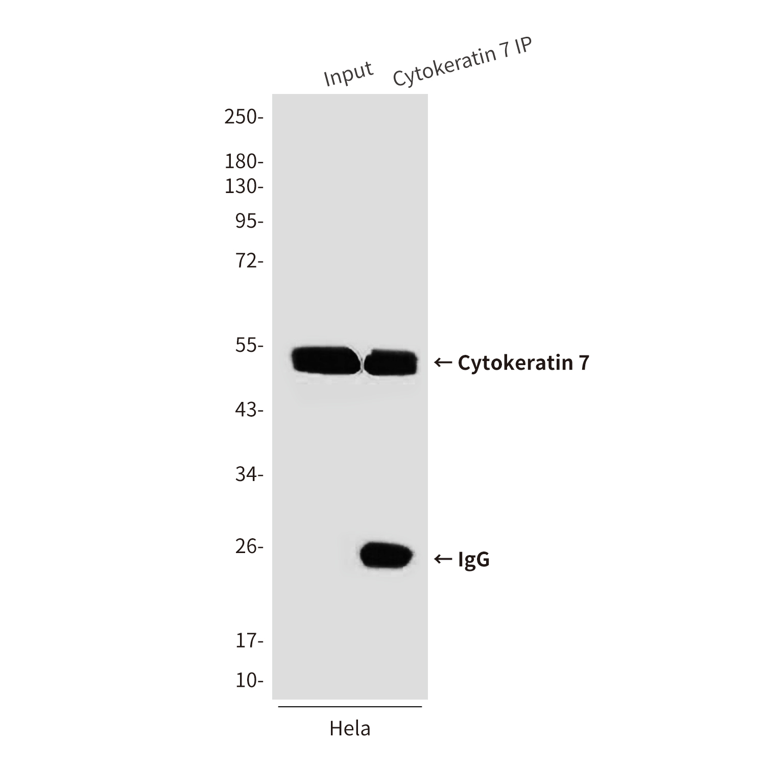 Mouse Monoclonal Antibody to Cytokeratin 7