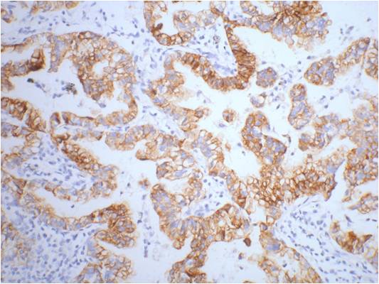 Mouse Monoclonal Antibody to Cytokeratin 7