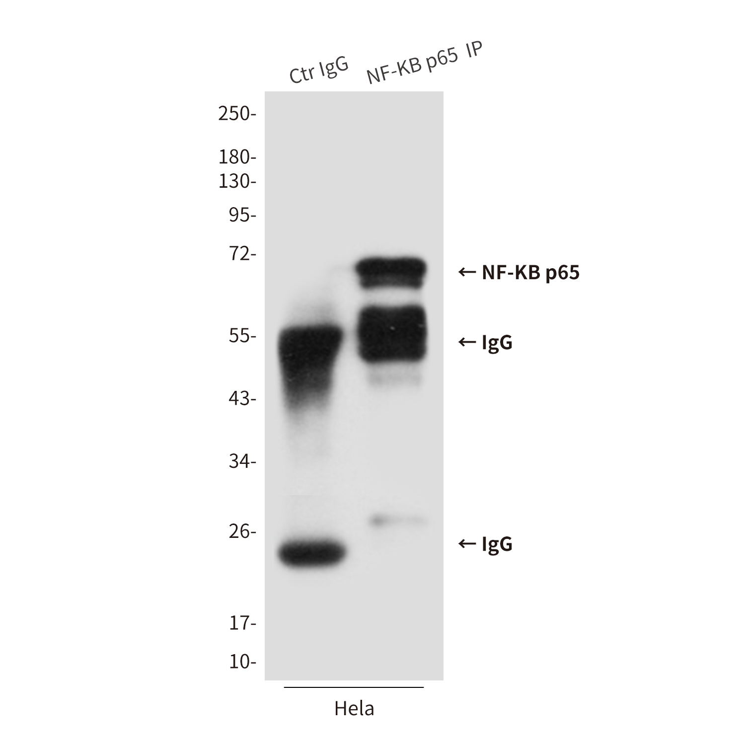 Mouse Monoclonal Antibody to NF-KB p65