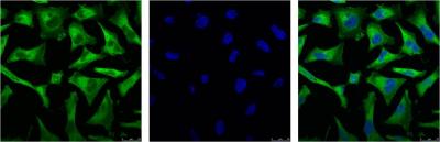 Mouse Monoclonal Antibody to NF-KB p65