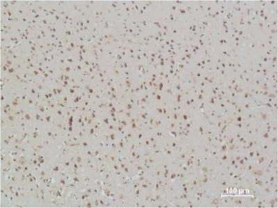 Mouse Monoclonal Antibody to NF-KB p65