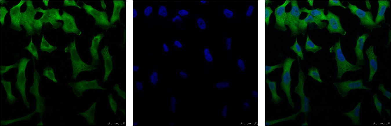 Mouse Monoclonal Antibody to eIF4A1