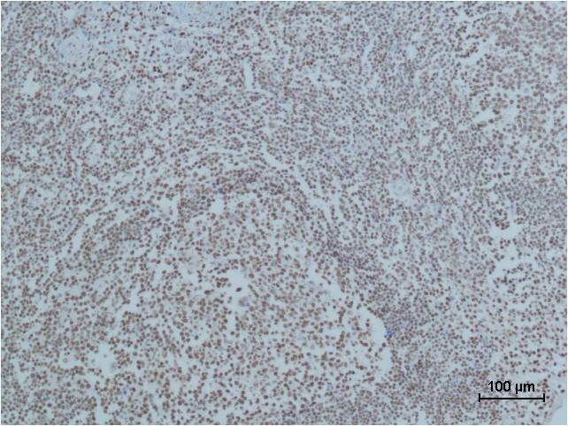 Mouse Monoclonal Antibody to PARP1