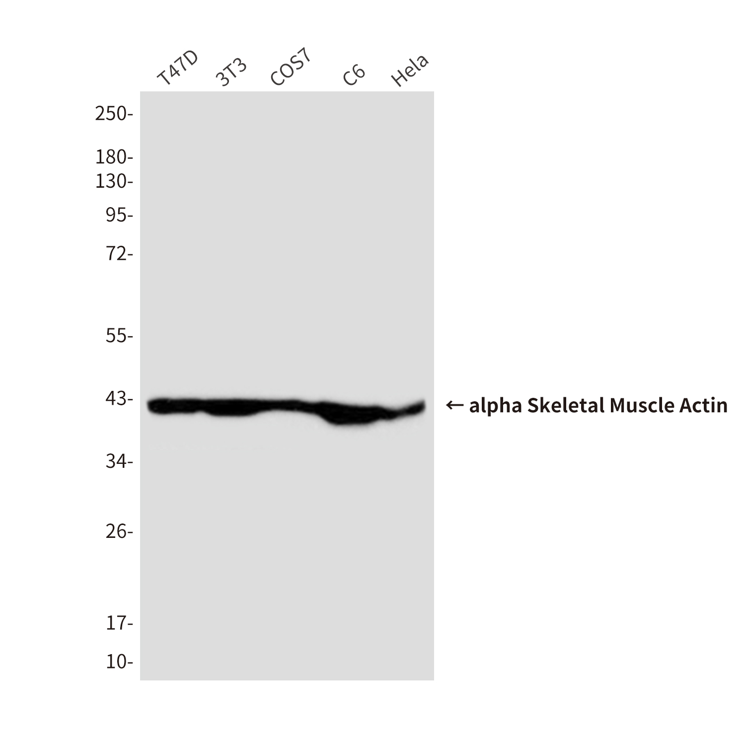 alpha Skeletal Muscle Actin