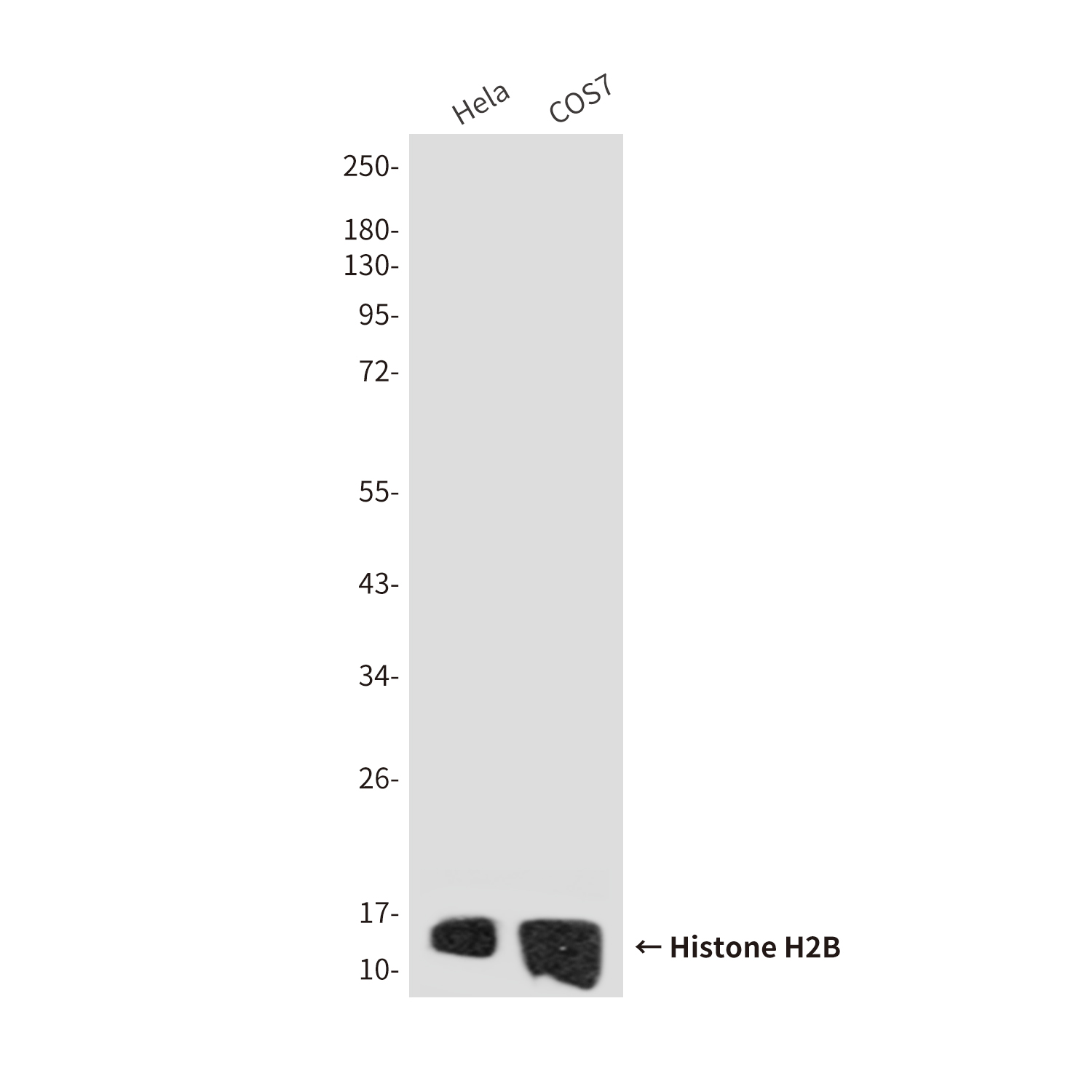 Histone H2B