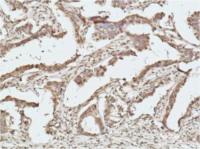 Mouse Monoclonal Antibody to Histone H2B