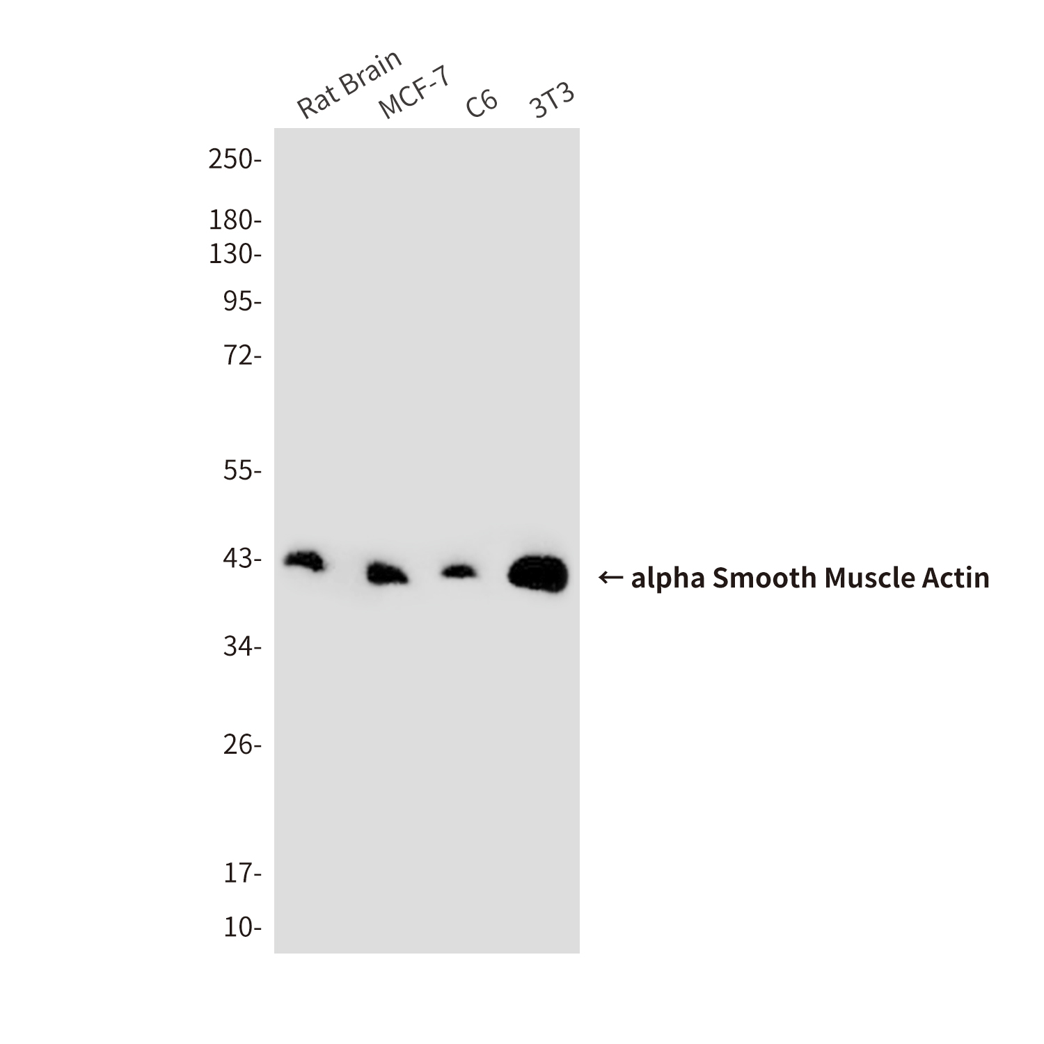 alpha Smooth Muscle Actin