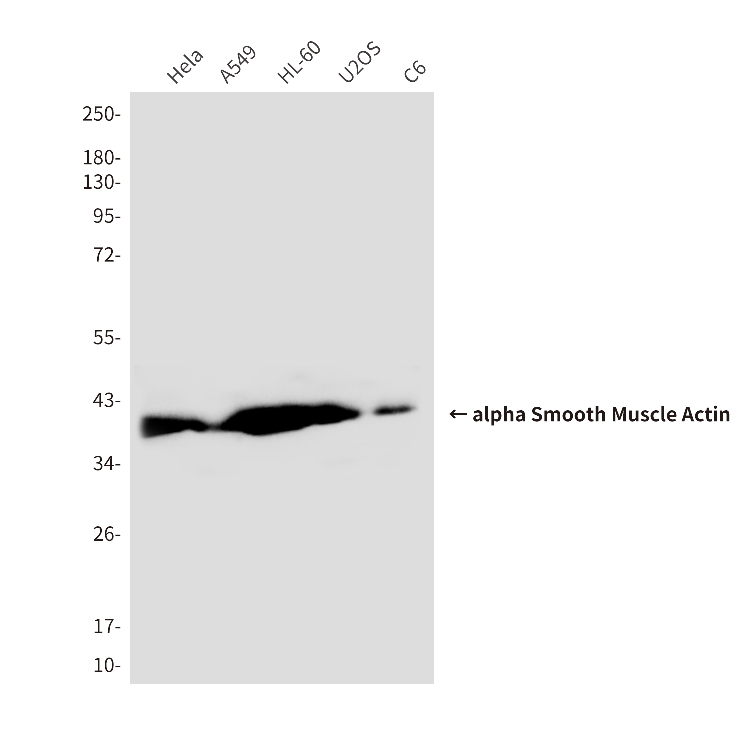 Mouse Monoclonal Antibody to alpha Smooth Muscle Actin