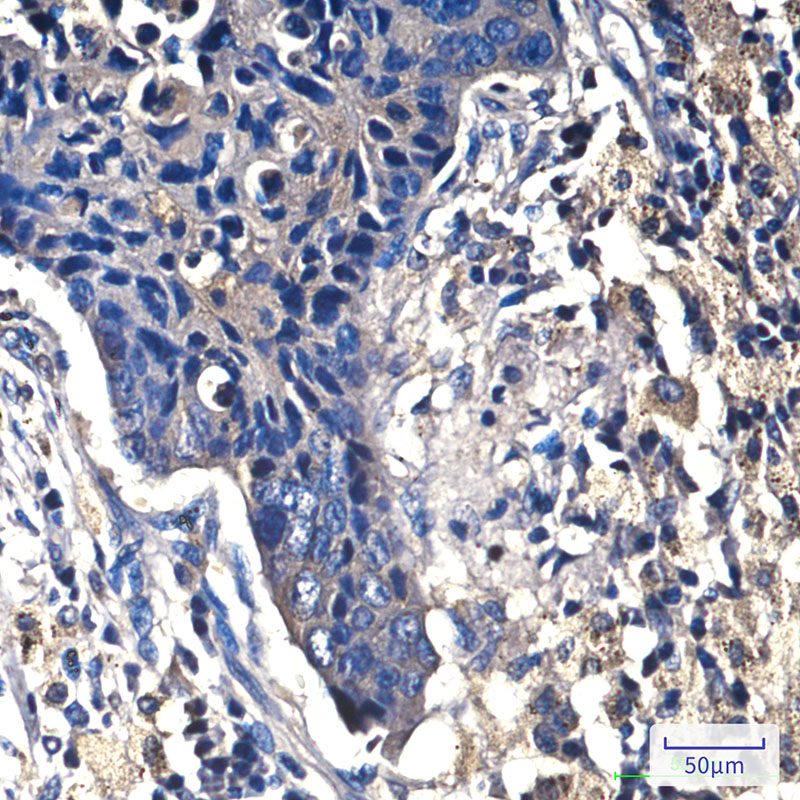 Mouse Monoclonal Antibody to beta Catenin