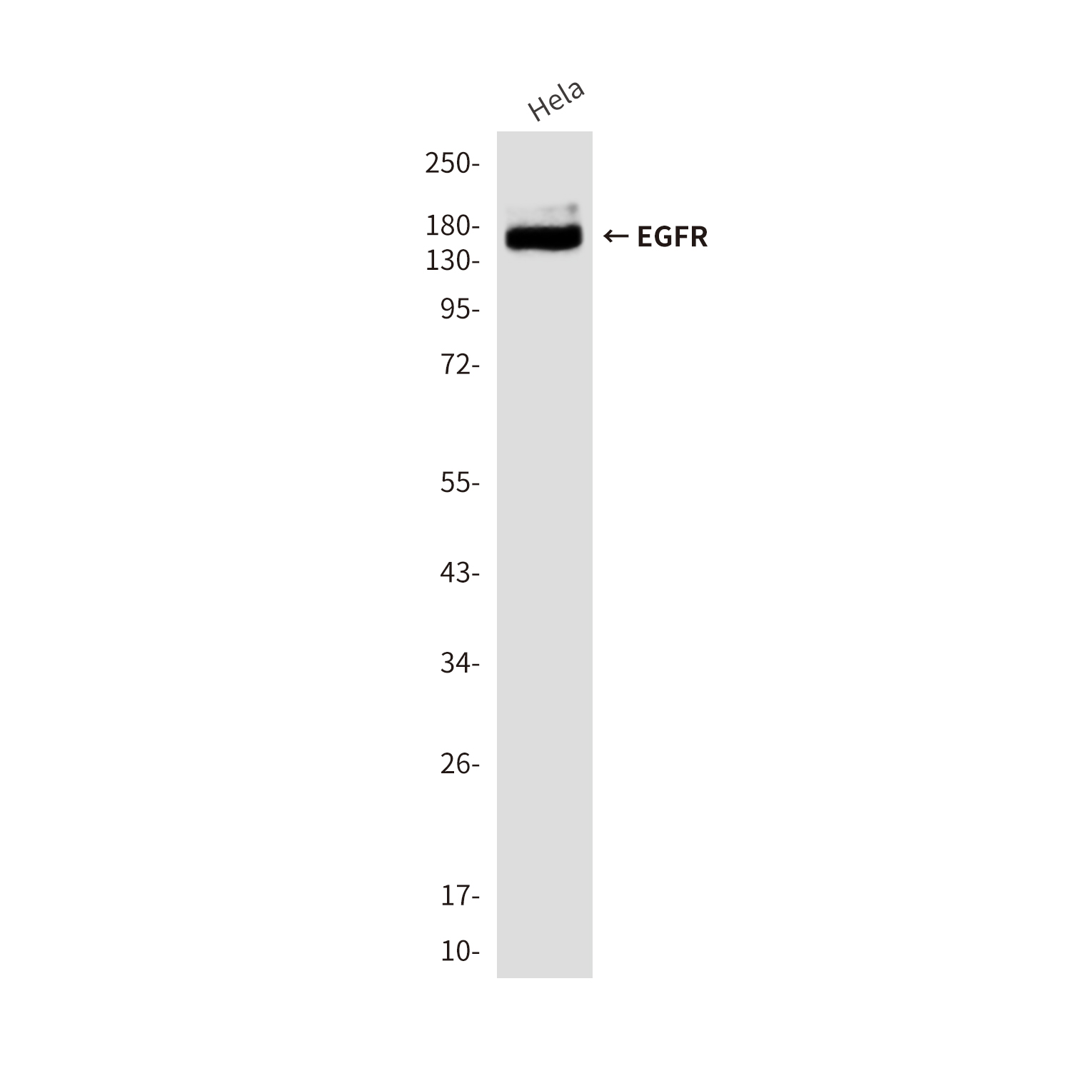 EGFR
