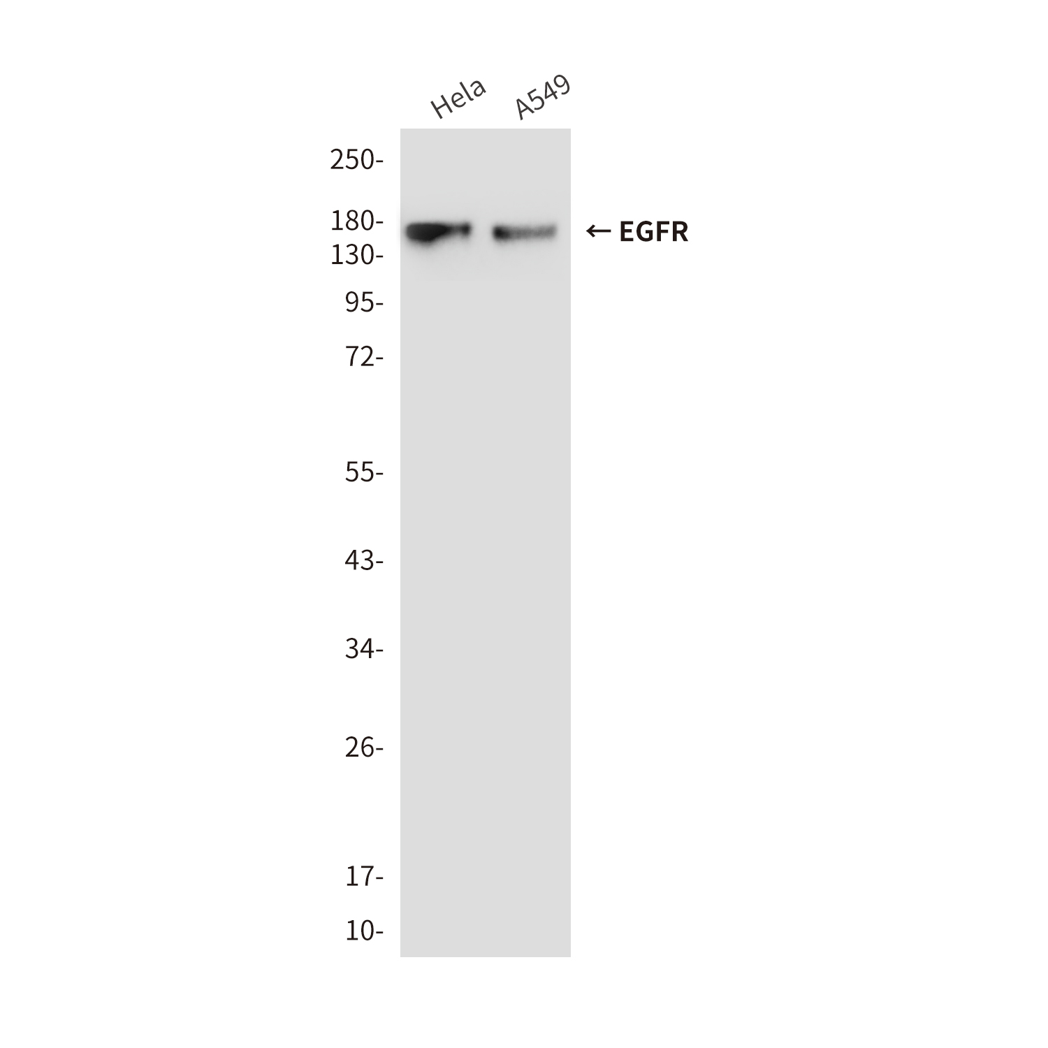 Mouse Monoclonal Antibody to EGFR