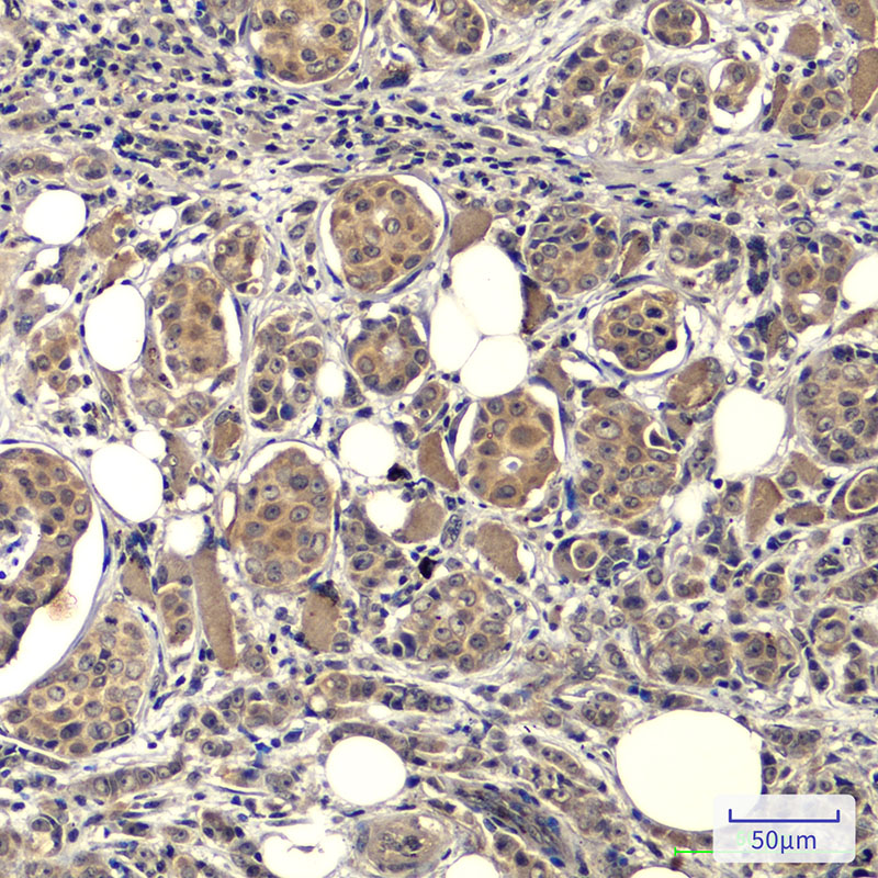 Mouse Monoclonal Antibody to EGFR