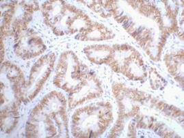 Mouse Monoclonal Antibody to p53