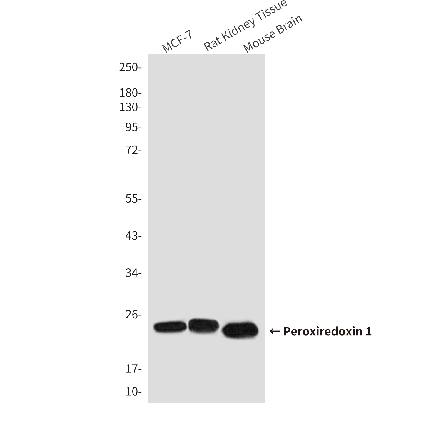 Mouse Monoclonal Antibody to Peroxiredoxin 1