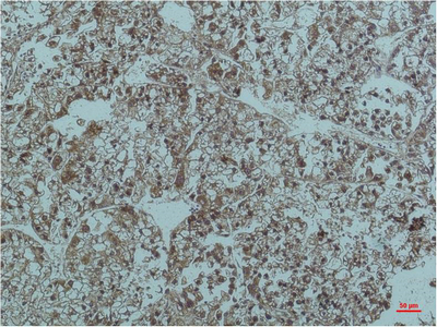 Mouse Monoclonal Antibody to Smad2/3
